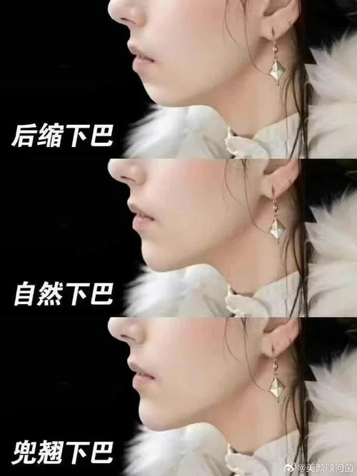 面相学下巴后缩的人-面相学后缩下巴