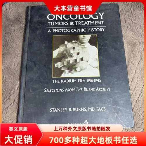 肿瘤的治疗历史_2