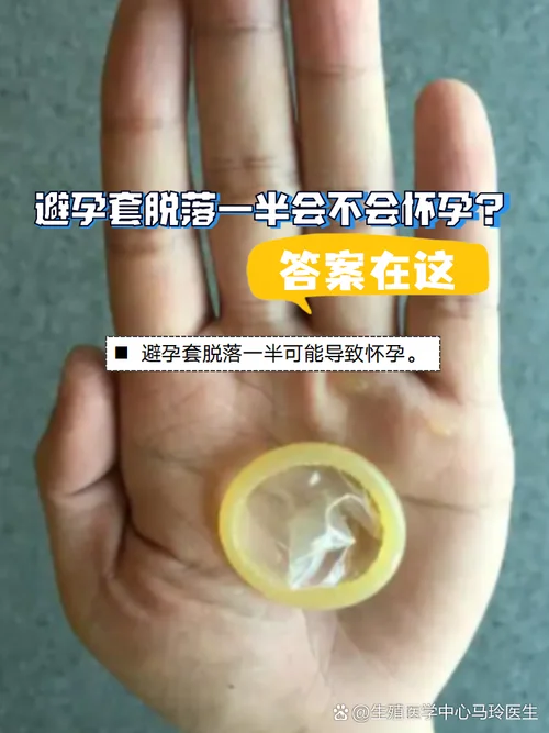 怀孕做梦梦到避孕套_2