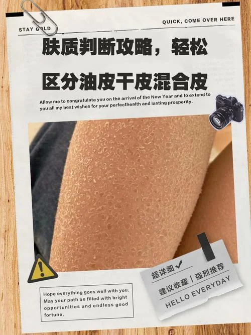 什么是干油皮_2
