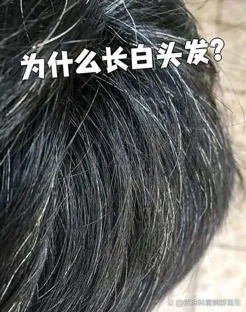 梦见自己头发白了_2