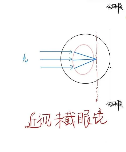 镜头调焦原理_2
