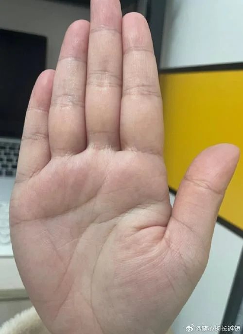 什么样的手相是元宝纹_2