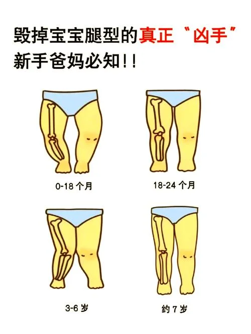 孩子畸形怎么办-孩子畸形如何治