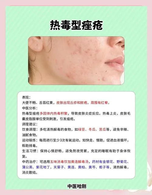 右脸颊长痘是为什么_1