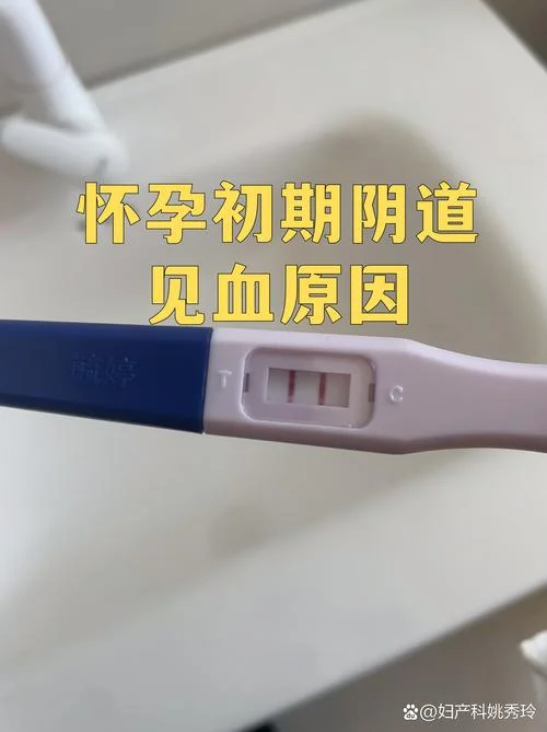 怀孕梦见见红了_2