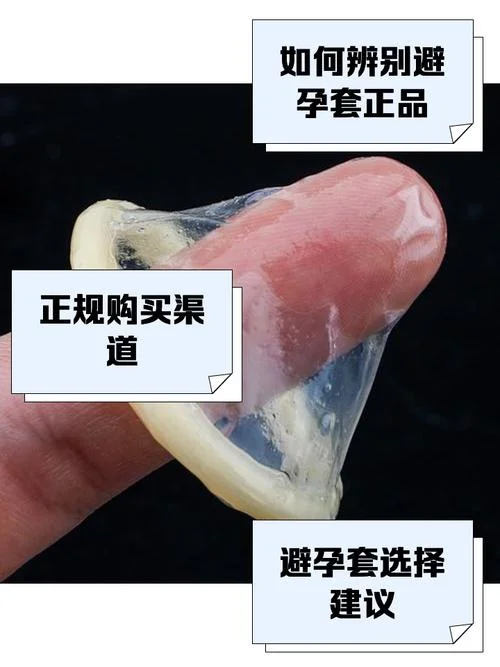 避孕套ck又叫什么名字_1