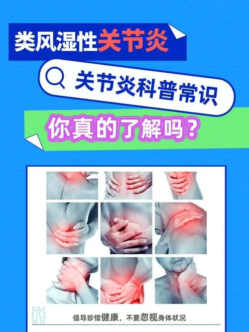 什么是风湿性关节病_1