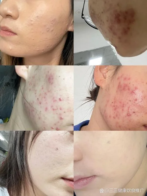 梦见自己的脸烂了_1