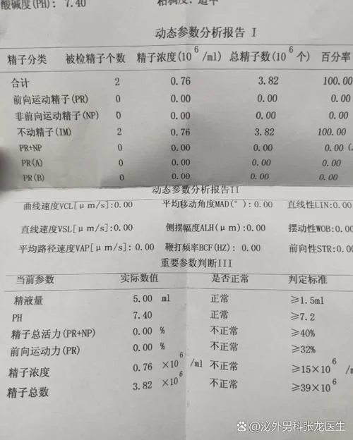 为什么我射精是透明的_2