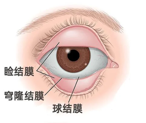 什么是结膜囊在眼睛的什么位置_2