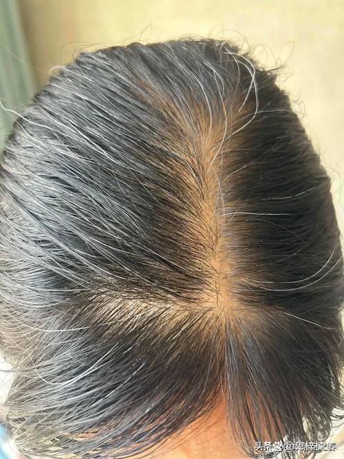 白头发用英语怎么读_2