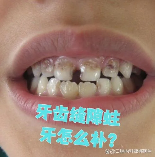 梦到牙齿坏了一排_1
