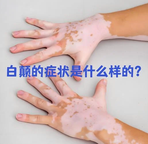 什么症状是颠_1