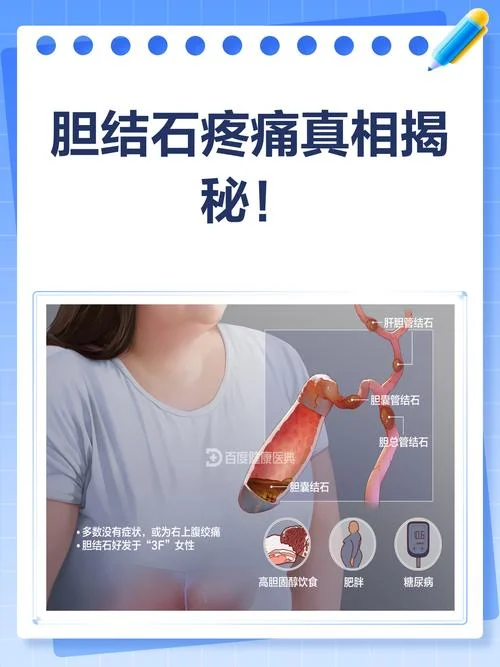 胆结石发了痛怎么办_1