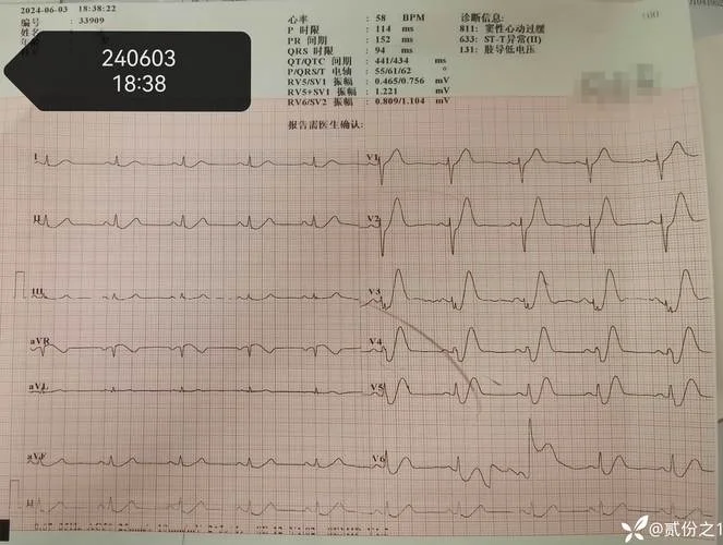 医学上ed是什么意思_1