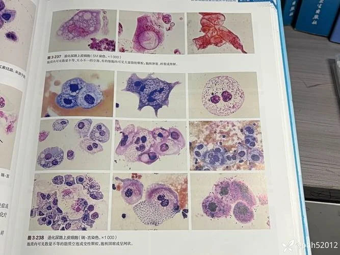 上皮细胞高是什么意思_2