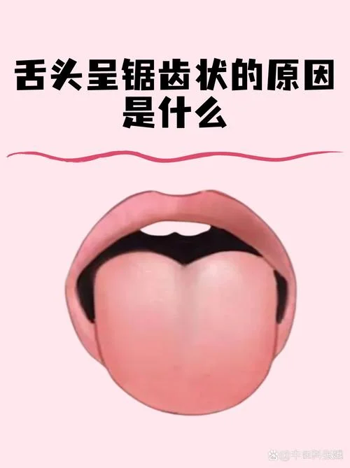 梦见舌头大了_2