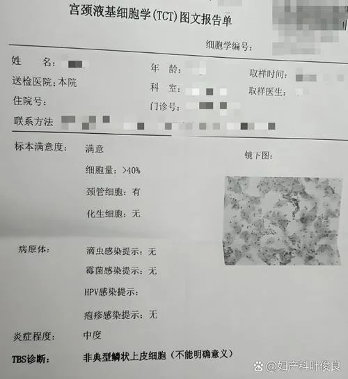 液基细胞检查怎么做_2