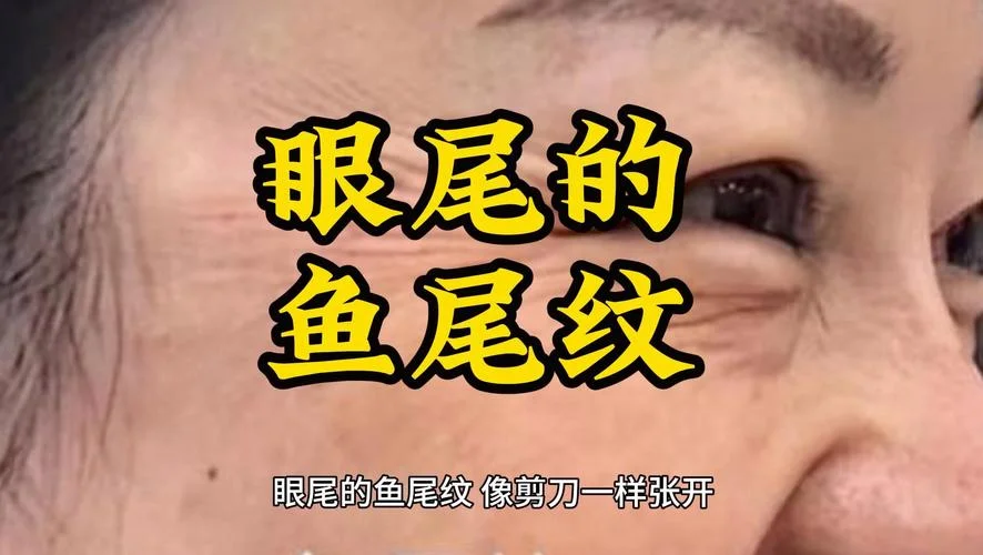 女生眼尾纹面相分析-女眼纹面相解读