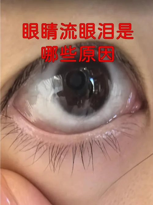 什么是泪堂_1