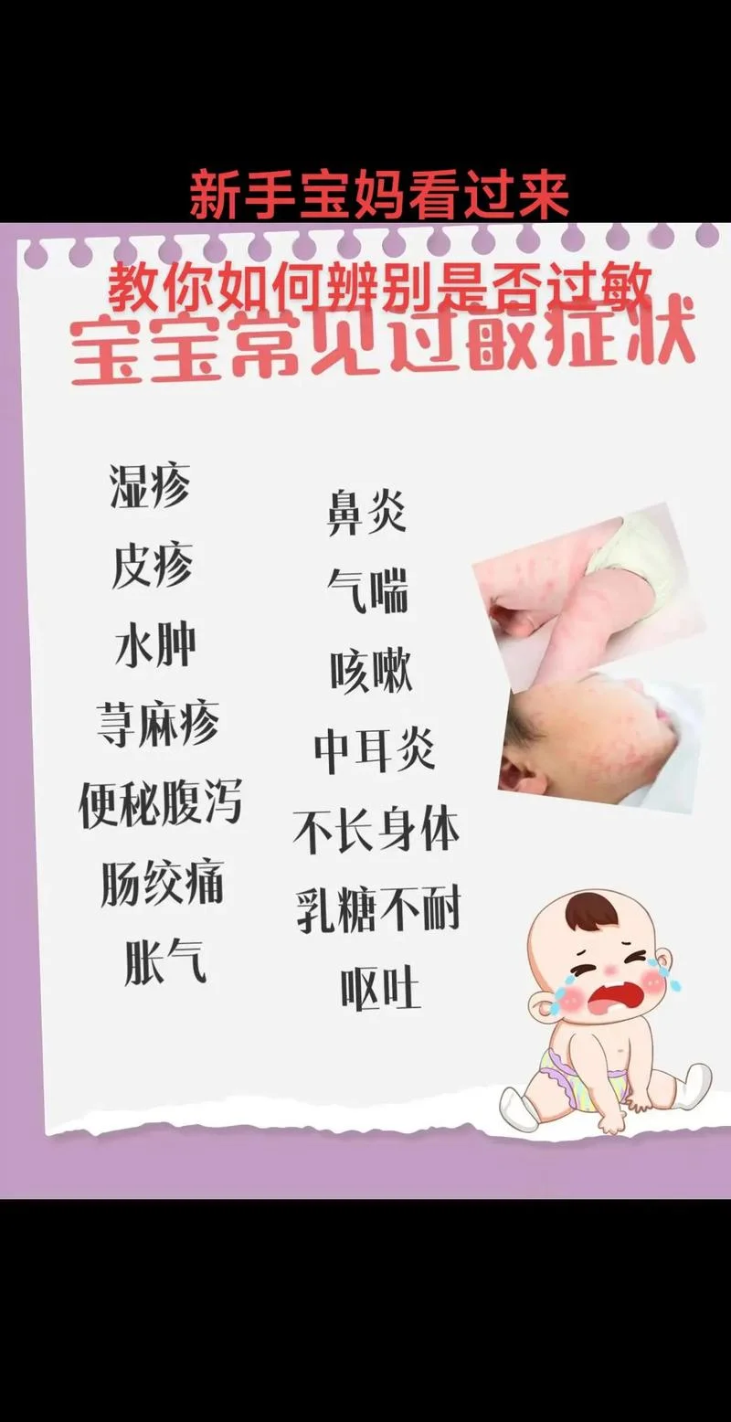 小孩易过敏体质怎么办-儿童易过敏怎么办
