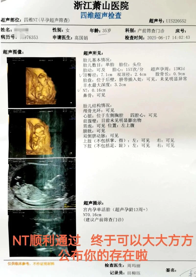 怀孕nt检查是什么项目_2