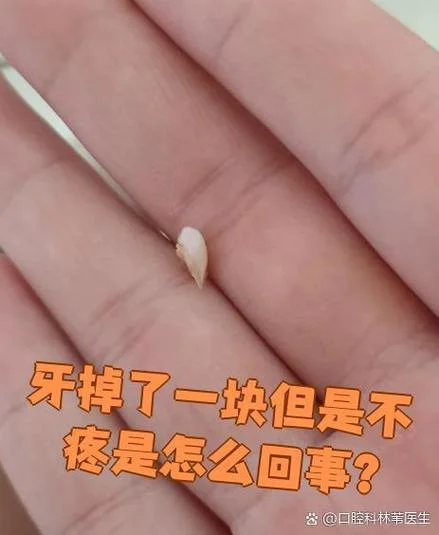 梦见掉牙没出血又不痛_1