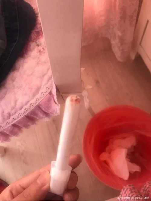 吸奶吸出粉色血怎么办_2