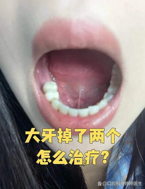 梦见自己掉了两颗牙_1