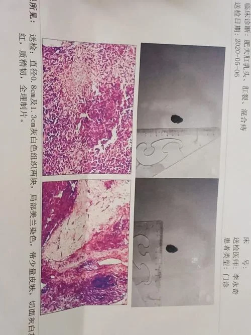 发霍乱子医学叫什么-医学称霍乱为