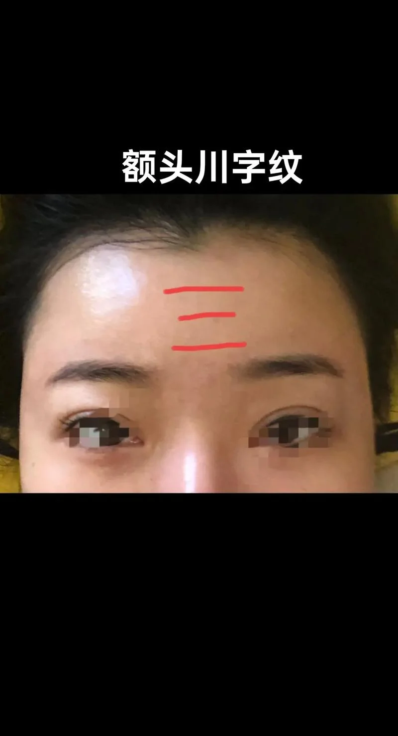 有川字纹的面相_2
