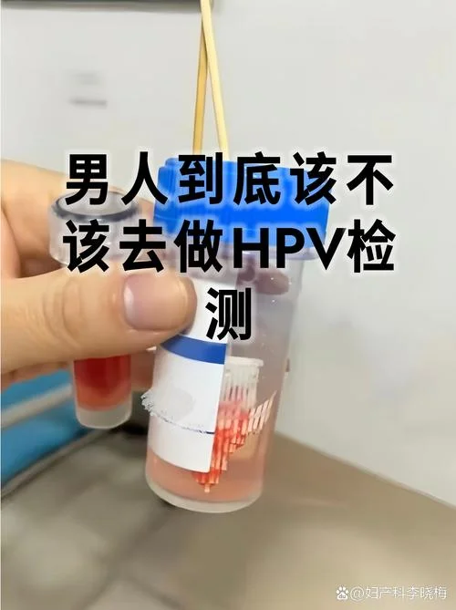 hpv男性如何查_2