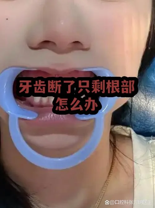 梦见牙齿折断_2