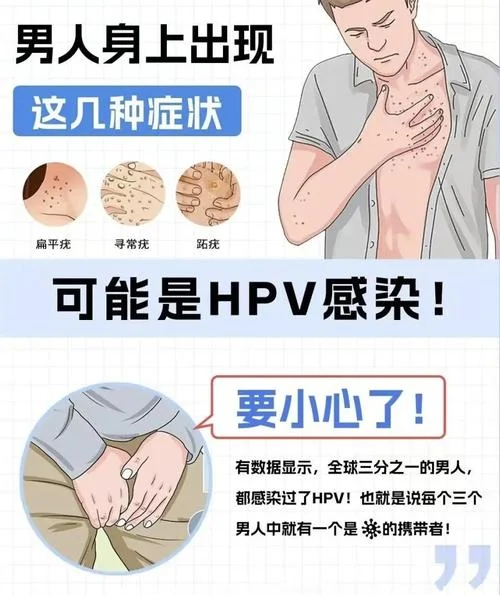 男性如何查hpv33_1