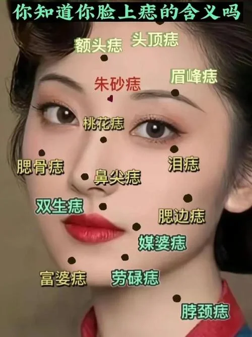 梦见别人脸上长痣图片_2