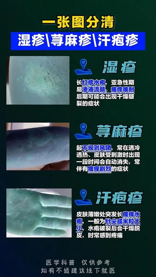 如何用扫一扫查皮肤病_1