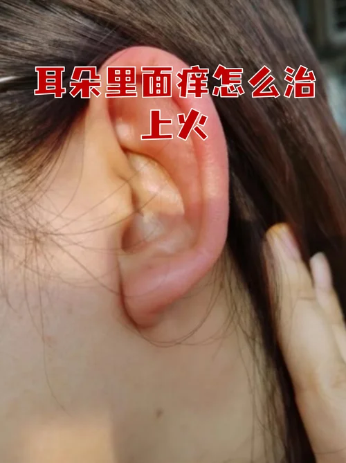 耳朵流脓还痒怎么办-耳流脓痒怎么办