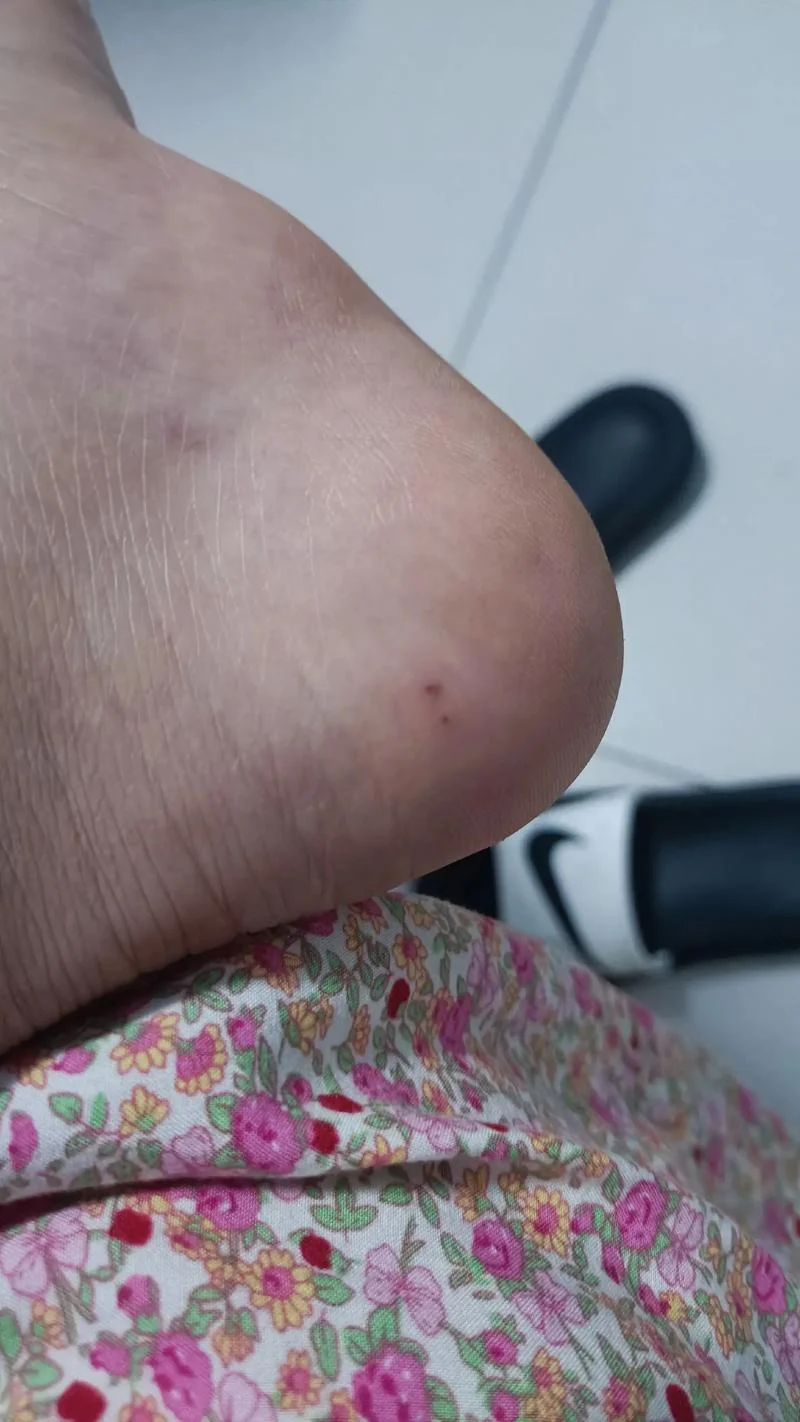 梦见蛇咬人的脚脖_1