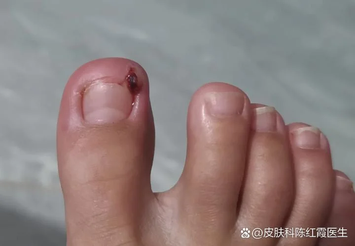 梦见脚大拇指烂了_2