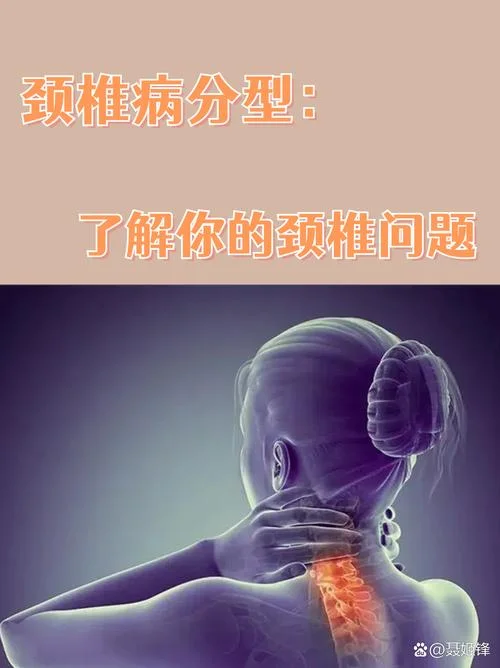 什么是混合型颈椎病_1