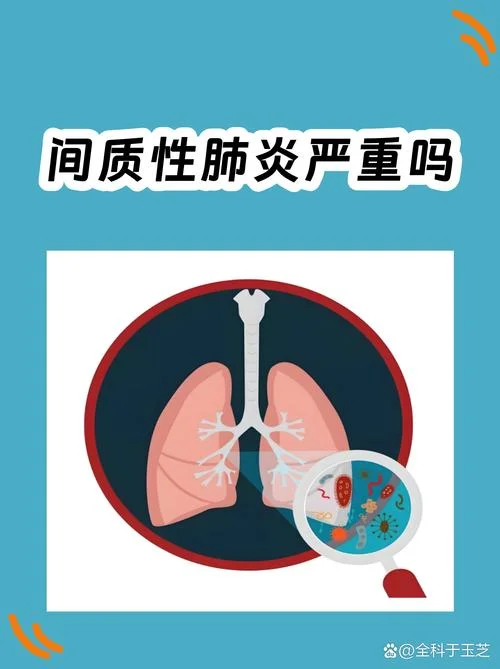 什么是双肺间质性炎症_1