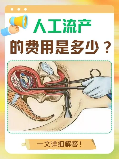 流产清宫怎么做-流产清宫怎么做