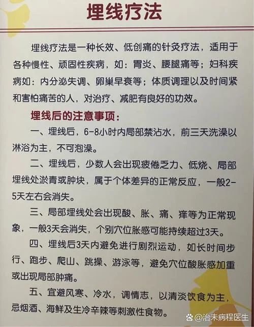 针灸埋线多少钱一次-