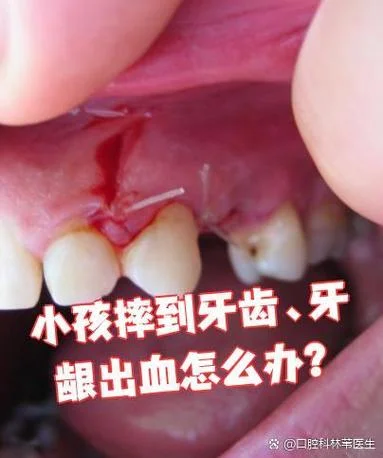 做梦掉了一颗牙齿出血_1