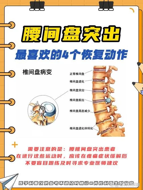 腰间盘突出自我保健操_1