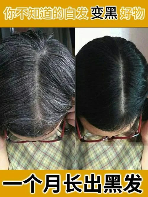 黑发底下感悟_1