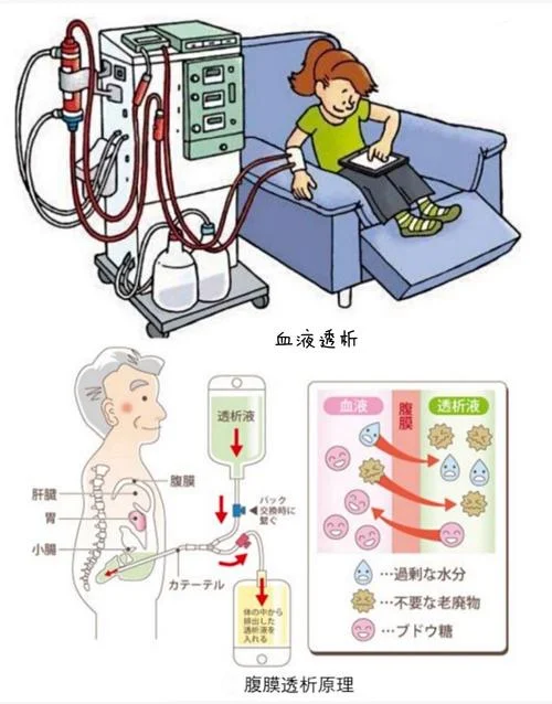 血液透析原理动画_1