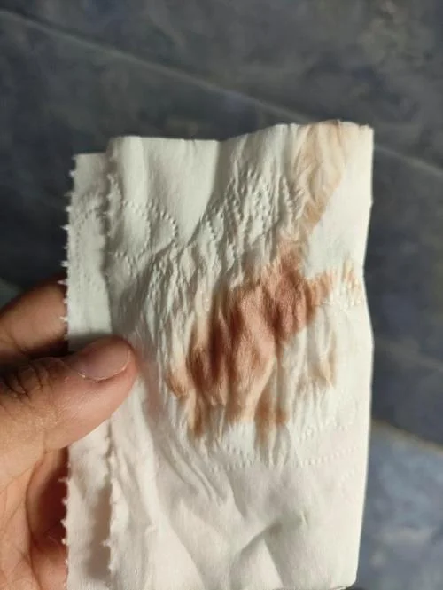 孕妇做梦梦到流血_1