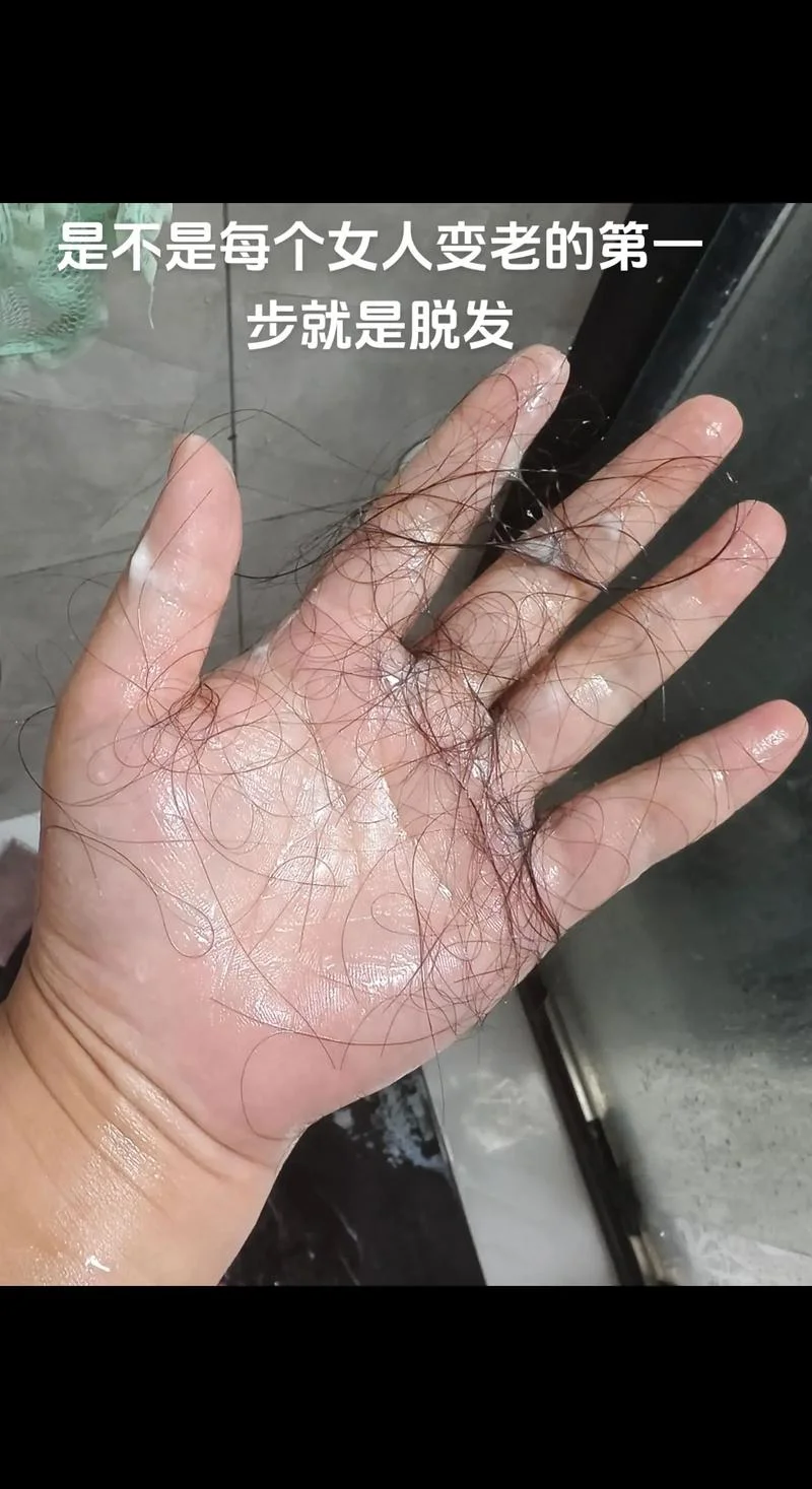 梦见头发掉了长出新发_1